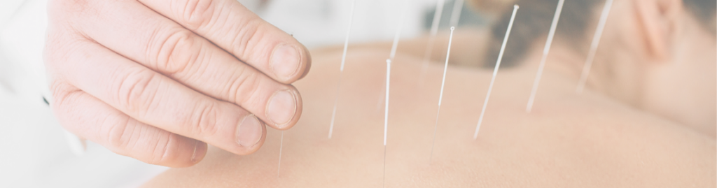 physician administering acupuncture for patient